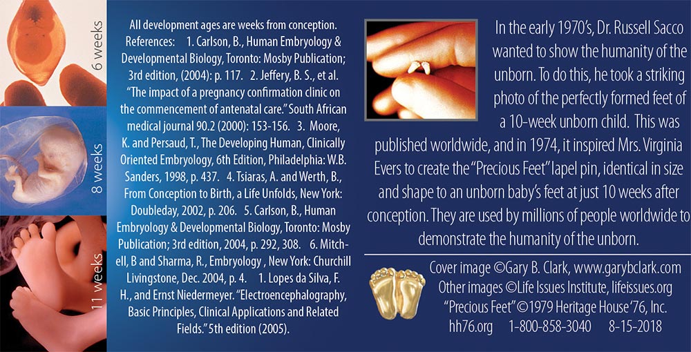 Jewelry, Lapel Pin, Precious Feet, Gold-Colored, Fetal Development Card