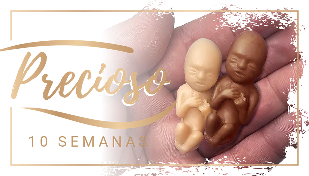 Fetal Model, Precious One,  10 Week Ethnic, Spanish Card: Pack of (50)