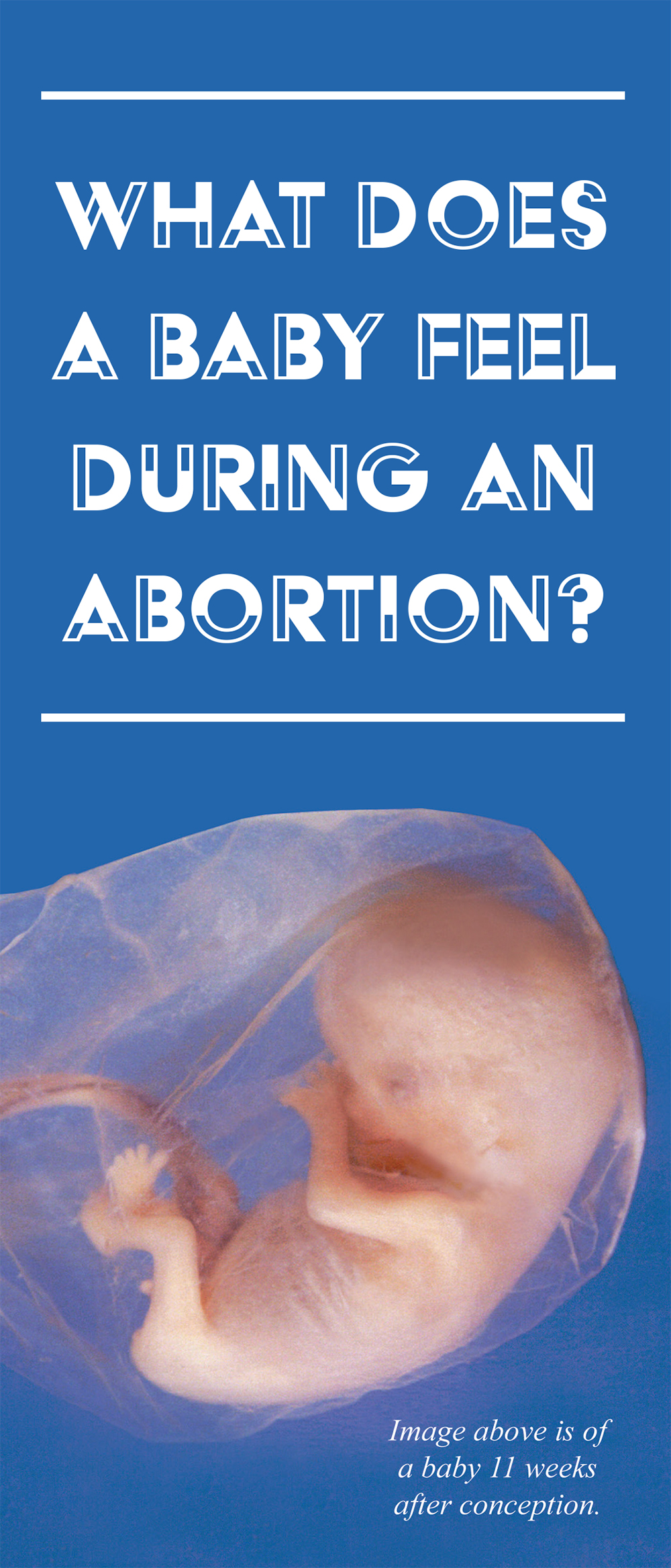 Literature, What the Baby Experiences During Abortion: 50/pk