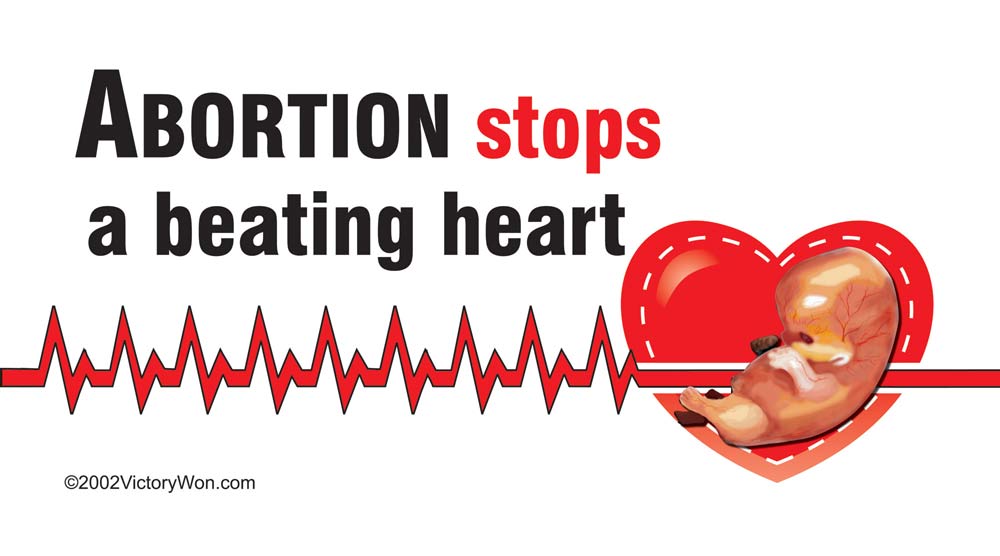 Vinyl Sign, Abortion Stops a Beating Heart